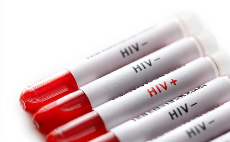 艾滋病无症状感染期/艾滋病无症状感染期是几年