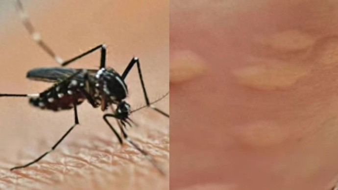 无症状感染者中境外输入占比增大(新增境外输入无症状感染)