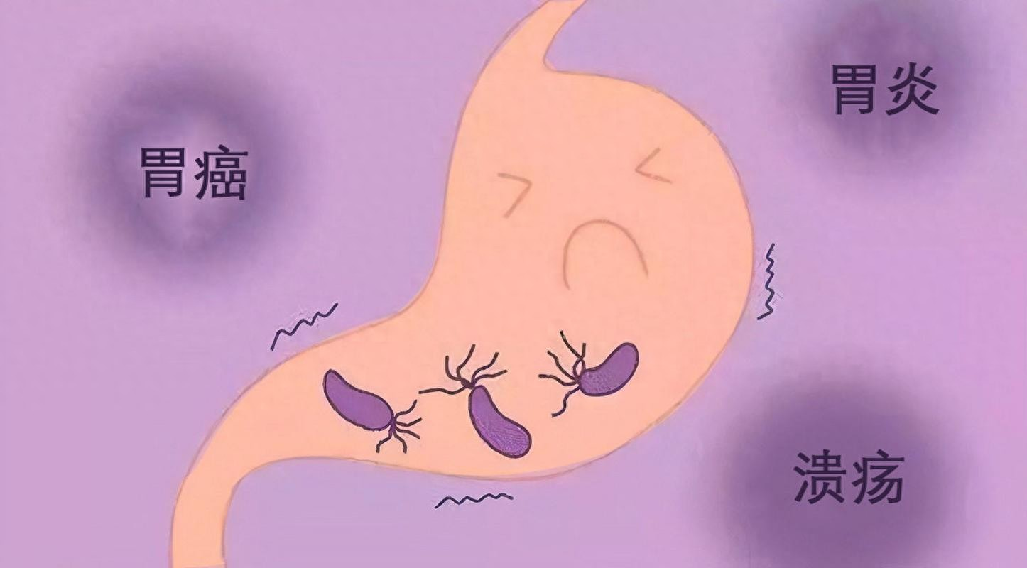 武汉无症状感染者在痊愈者中占比极低(武汉无症状感染患者)