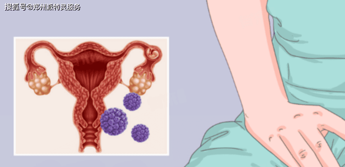 【感染病毒无症状/病毒无症状感染者什么情况】