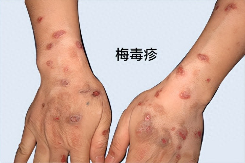 新增确诊40例含本土32例(新增34例无症状感染)