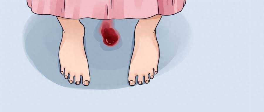 妇科支原体感染不治会怎么样(妇科支原体感染无症状)